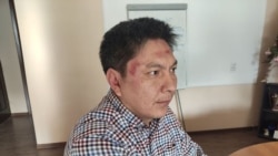 Болот Темиров после нападения на него неизвестных. 9 января 2020 года.