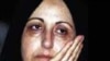 Iranian Nobel Prizewinner Says Rights Abuses Increasing